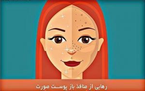 منافذ باز پوست صورت