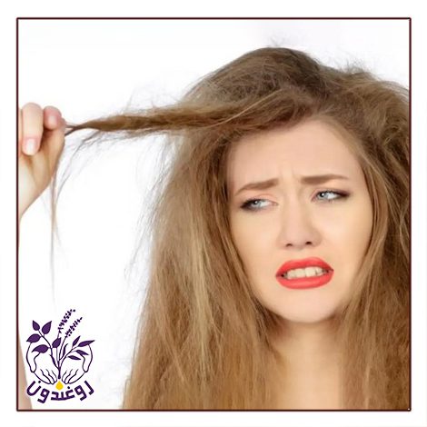 چرا من موهای خشکی دارم ؟