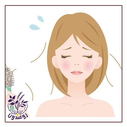 ریزش موی هورمونی