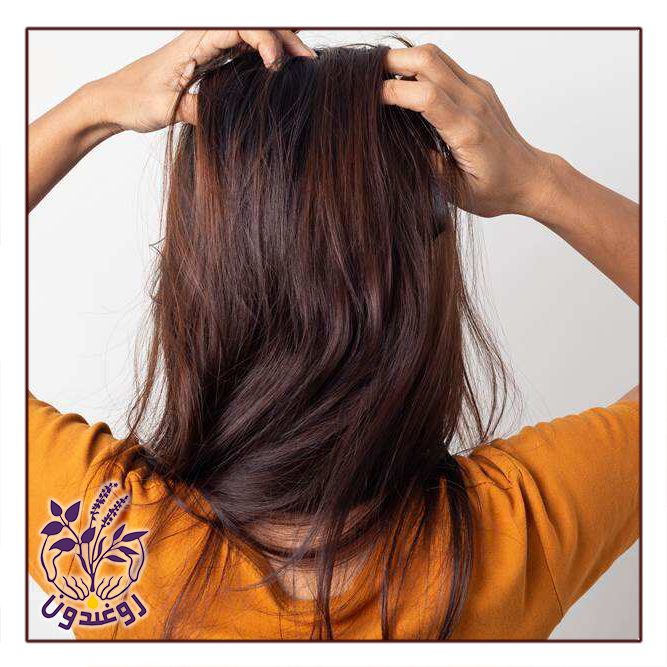 خشکی پوست سر