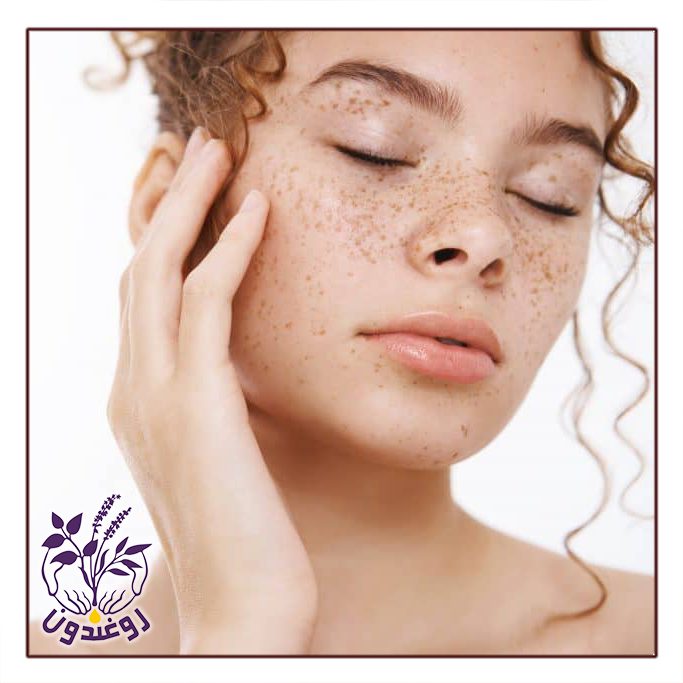 لک‌ های قهوه‌ ای