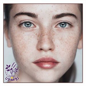 لک های قهوه ای
