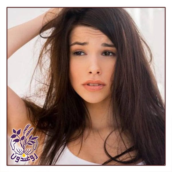 چرب شدن موها