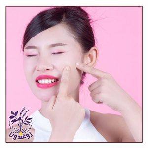 دلایل تشدید آکنه