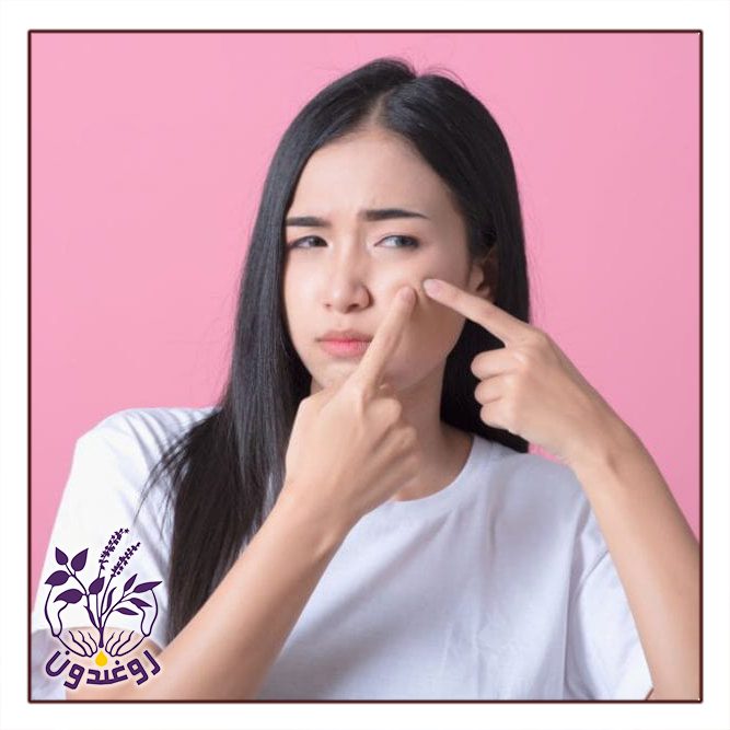 دلایل تشدید آکنه