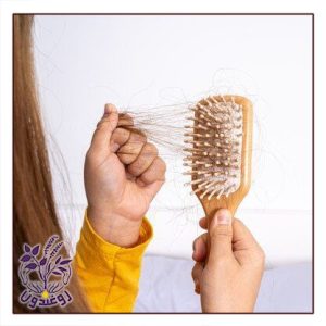 ریزش مو ارثی