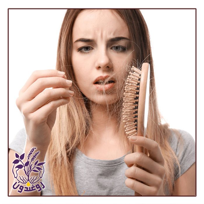ریزش مو ارثی